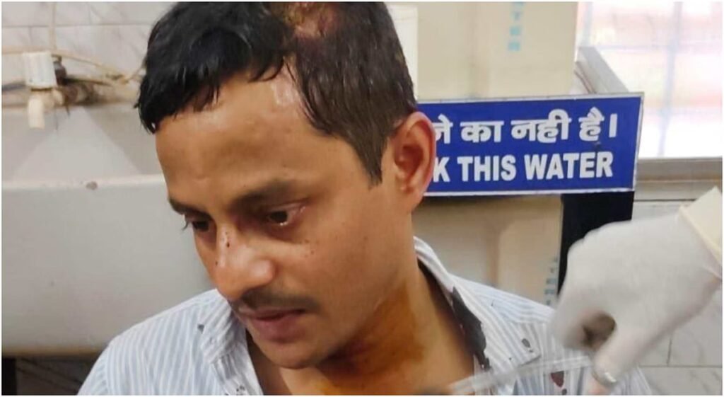 बिहार:एसटीएफ इंस्पेक्टर पर हेलमेट से हमला, सिर फटा; भाजपा नेता ज्योति शेखर सिंह हिरासत में – Patna Stf Inspector Amit Kumar Helmet Attack Bjp Leader Jyoti Shekhar Singh Detained