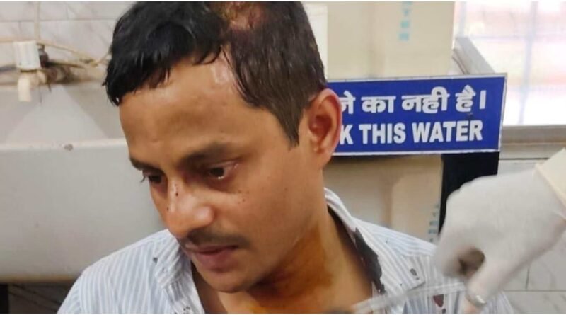 बिहार:एसटीएफ इंस्पेक्टर पर हेलमेट से हमला, सिर फटा; भाजपा नेता ज्योति शेखर सिंह हिरासत में – Patna Stf Inspector Amit Kumar Helmet Attack Bjp Leader Jyoti Shekhar Singh Detained